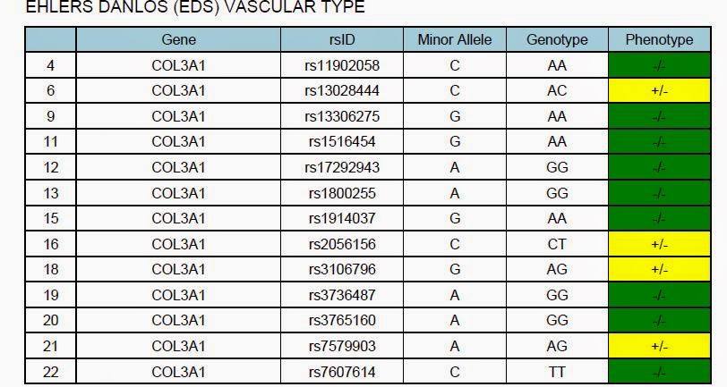 Ehlers-danlos syndrome type iv Life with Ehlers Danlos Syndrome: Genetics Ehlers Danlos Syndrome and Me