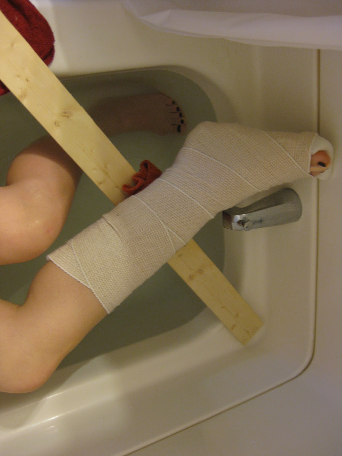 Claiming Mrs. Edgerton How to Shower After Foot Surgery.