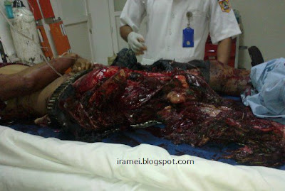 Video Tragedi Petasan Nambo di Pemalang - Berita Indonesia