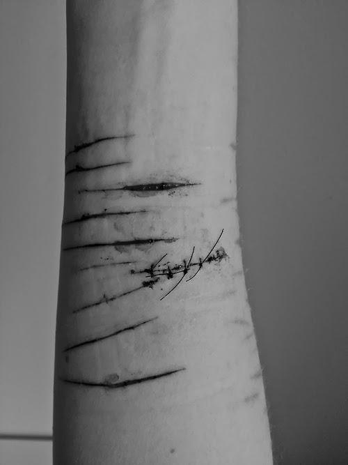 dem scars