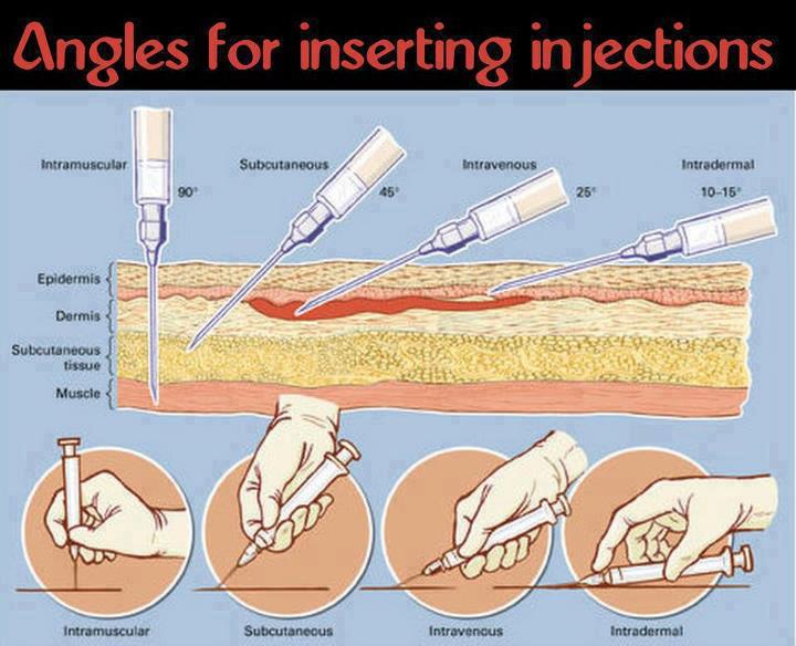 МαSк® Angles for injections...