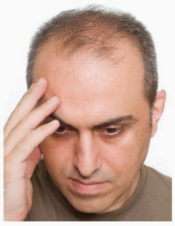 How To Stop Hair Loss Effective Ways To Prevent Hair Loss
