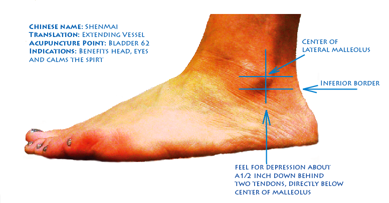 acupuncture insomnia acupuncture insomnia