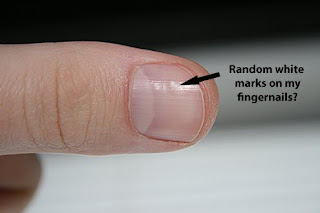 White Spots Under Fingernail Bed White Spots Under Fingernail Bed