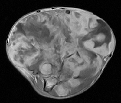 mri of soft tissues essay The aim of this essay is to demonstrate the mr findings of vault lesions, their signal intensities and their extension to soft tissues method a retrospective. mri of soft tissues essay The aim of this essay is to demonstrate the mr findings of vault lesions, their signal intensities and their extension to soft tissues method a retrospective.