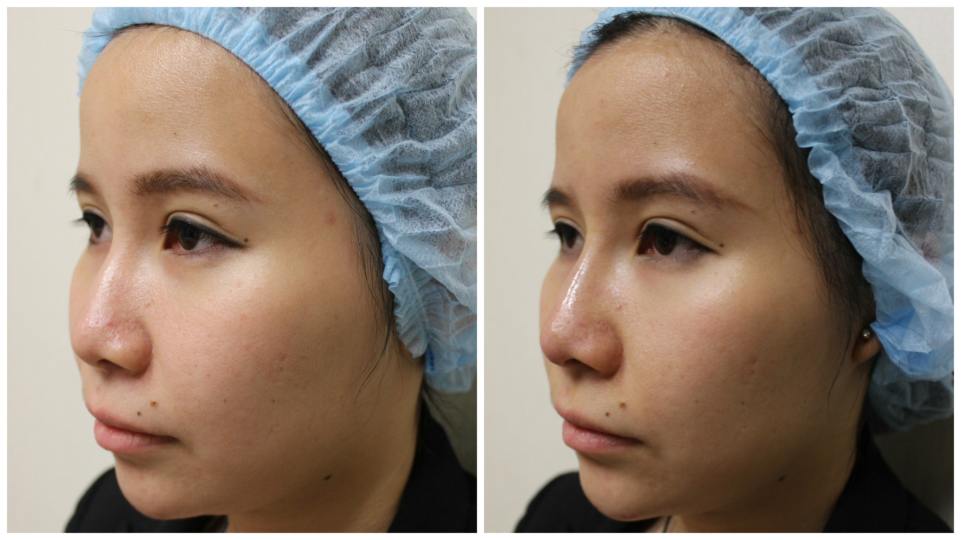 Does Nose Threading Hurt at Lola Orlando blog