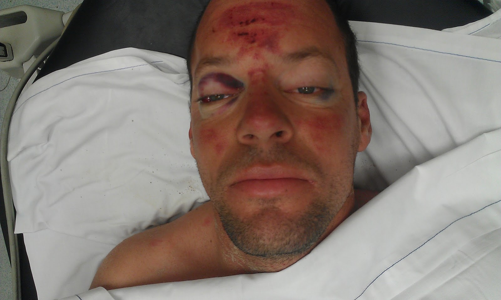 joshs journey the turning point severed spinal cord