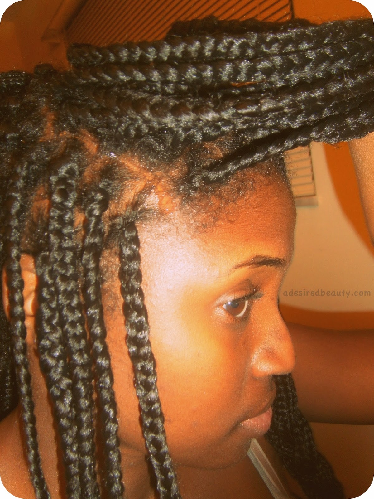 5 Tips To Relieve A Dry Itchy Or Irritated Scalp From Box Braids A Desired Beauty Scalp Braids Braids Box Braids