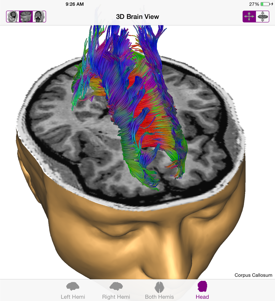 Tobacco smoking and nicotine dependence produce harmful effects on the brain.