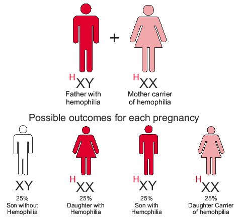 hemophilia genetics