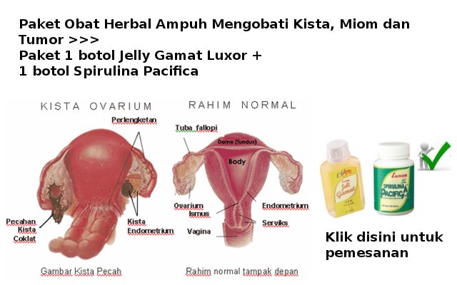 Apa yang dimaksud dengan kista? | Agen Resmi Jelly Gamat Luxor - 0813