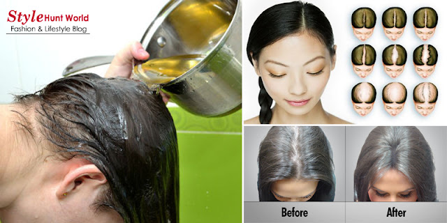 How To Stop Hair Loss Among Men And Women Hair Loss Home