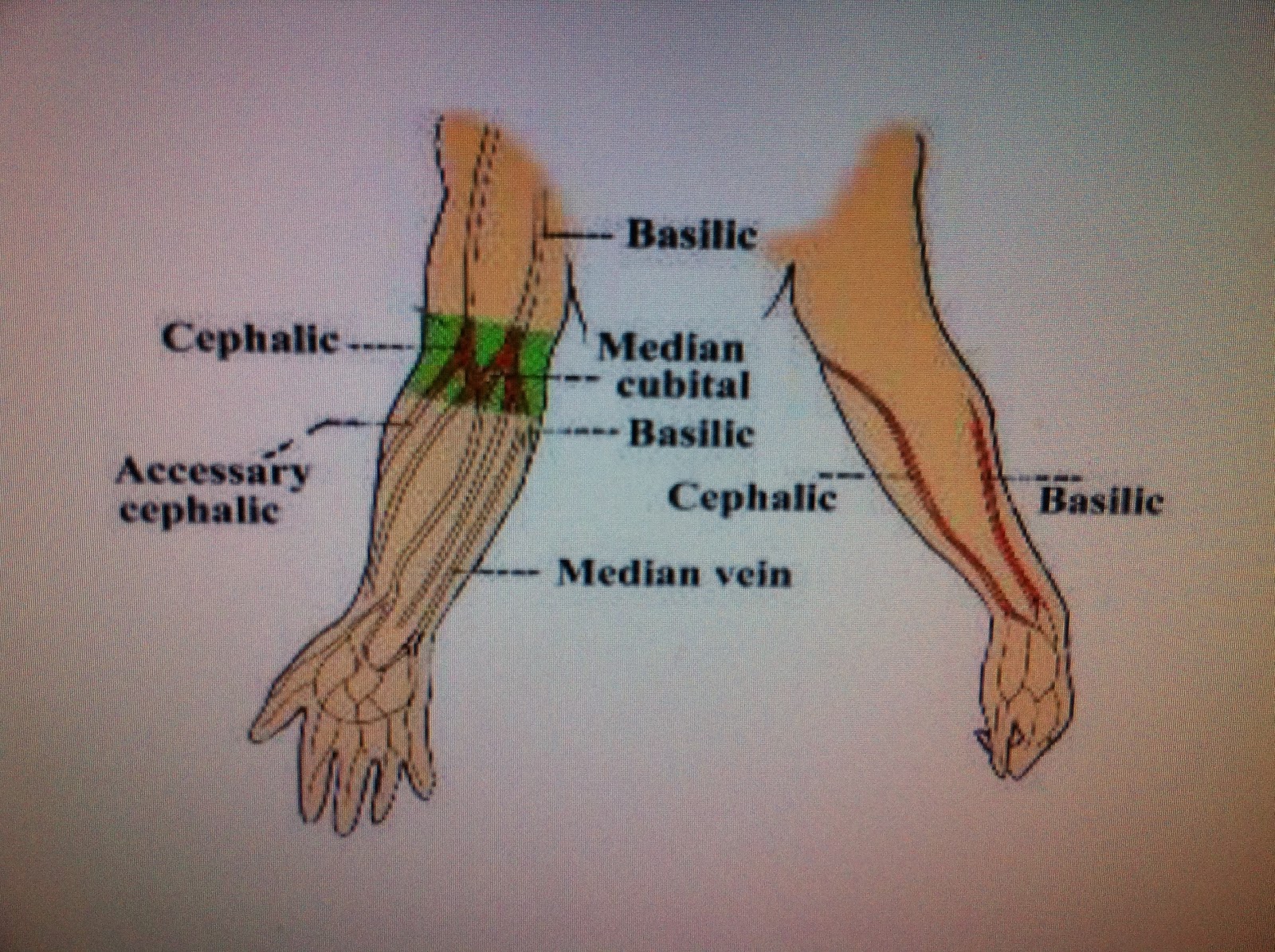 family medicine uitm: Blood Taking Procedures