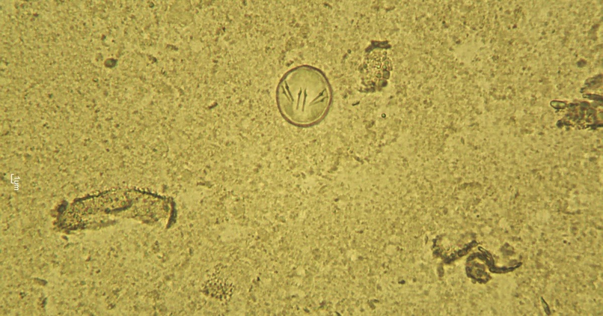 Exclusively Cats Veterinary Hospital Blog Why does my cat have grains of rice in its fur