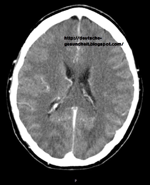 was sieht man im ct schädel
