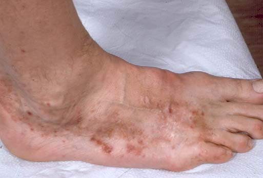 Skin Scaly