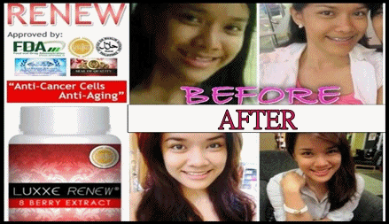 LUXXE RENEW (BEFORE&AFTER)