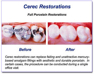 mercury poisoning symptoms mercury poisoning symptoms