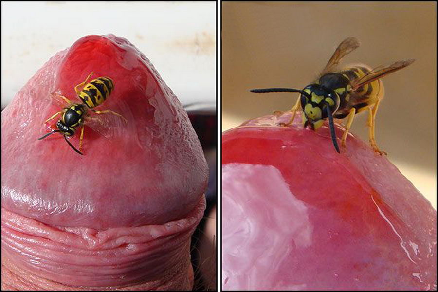 Are Mosquito bite on penis or cock think already Accept. interesting Mosquito bite on penis or cock thanks