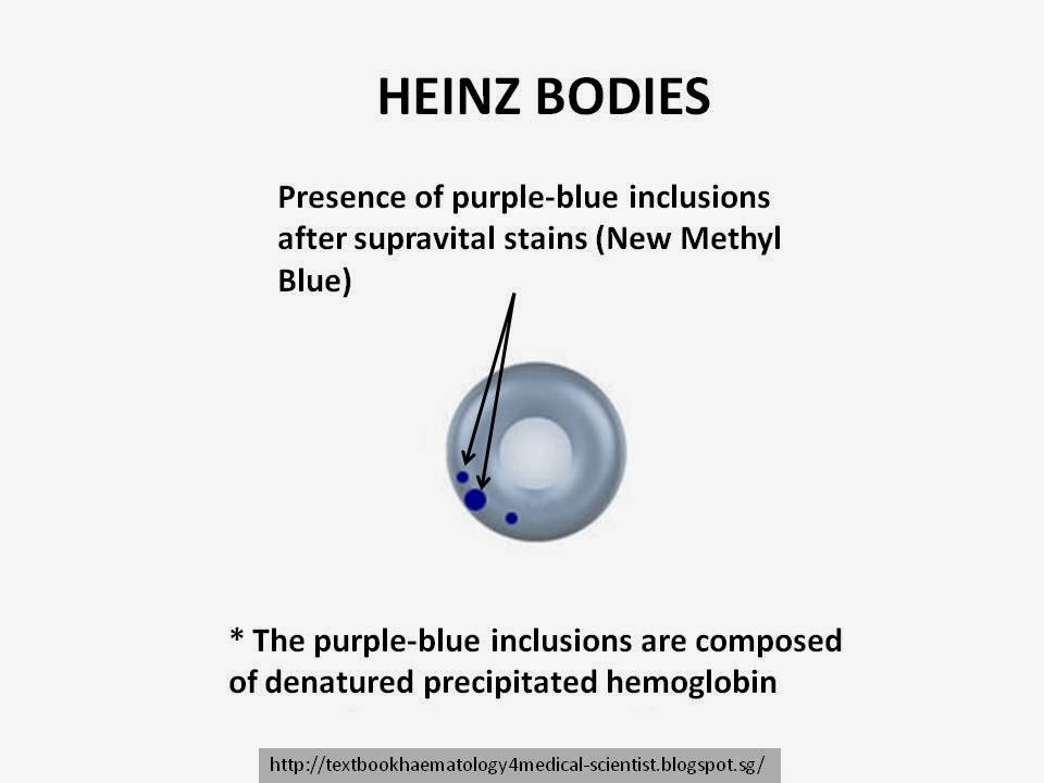 Haematology in a NutShell Heinz Bodies