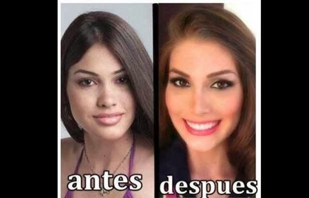 Que pinchazos de la belleza hace elena malysheva