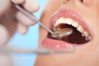 Tips menjaga kesehatan gigi