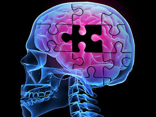 Do the Anti-Alzheimer's Effects of Grape Seed Extract (GSE) Start in the Gut? Your Gut Bugs Could Save Your Brain