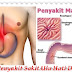 Obat Sakit Ulu Hati Dan Maag Tradisional