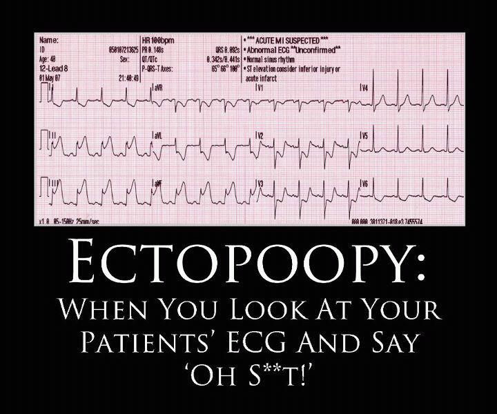 ER Nurses Care: Friday funny: Ectopoopy
