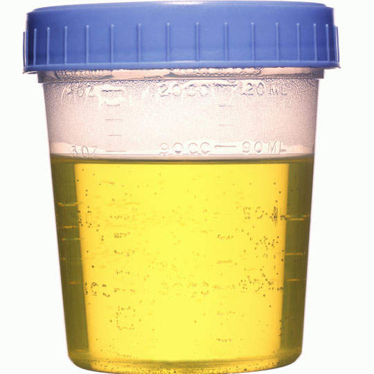 Urine For Acne