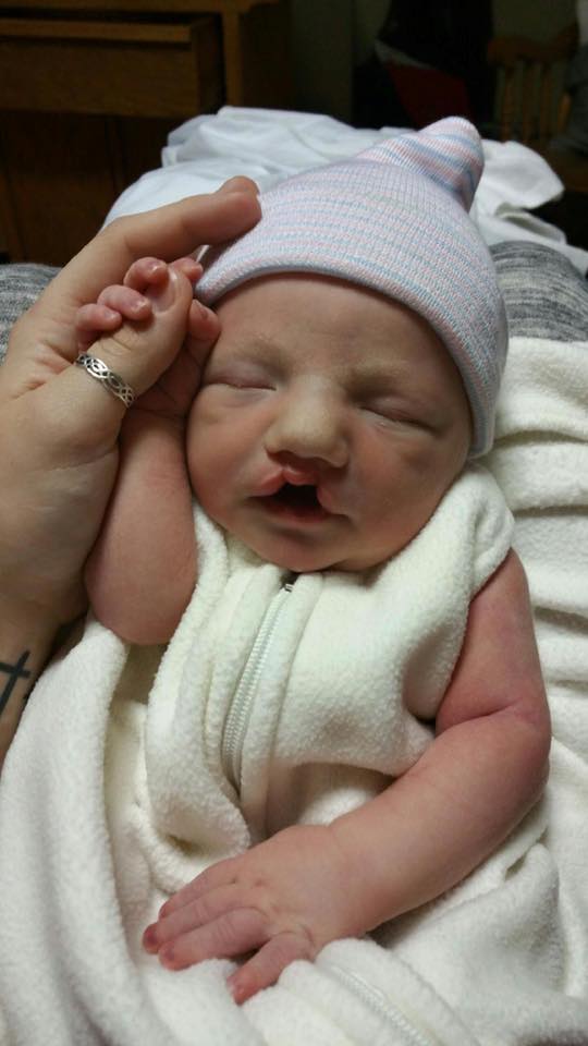 Mama Bean Parenting Cleft Lip and Breastfeeding One Mom's Story