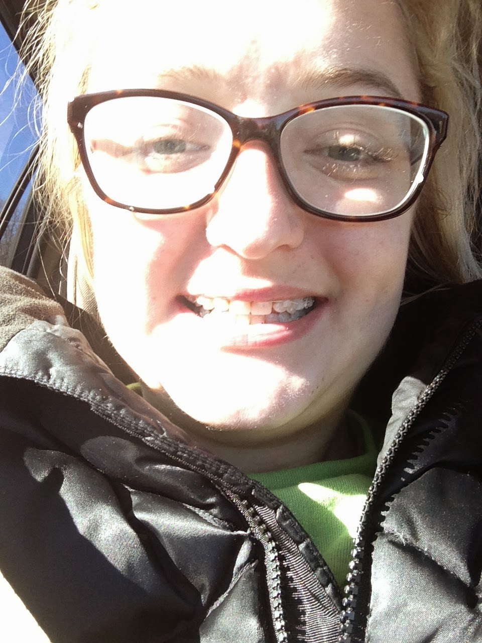 Wisdom Tooth Fiasco My Bout With Osteomyelitis