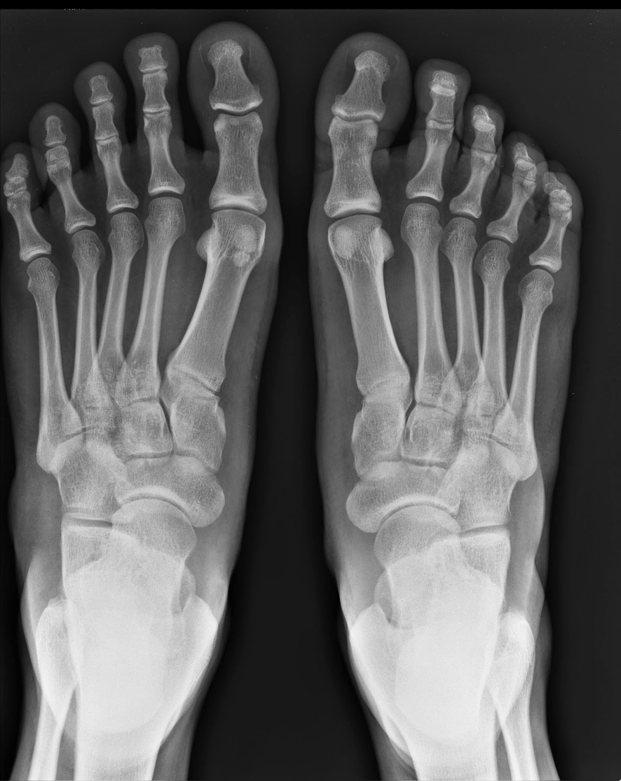 Community Foot Specialists Podiatrists in Springfield and Dayton, Ohio