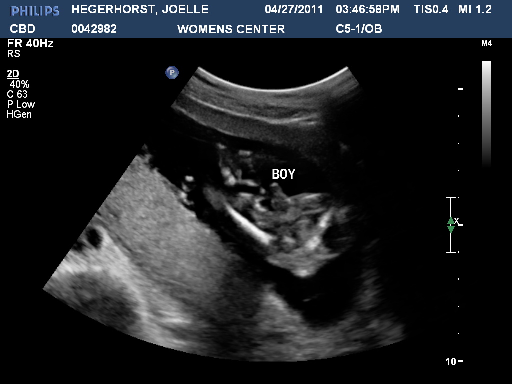The Hegerhorst�s Keagan Vaughn&hellip;Baby BOY 2 18 week