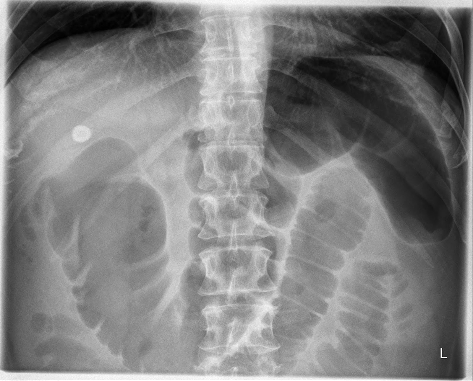 the xray doctor xrayoftheweek 13 can you pinpoint the site of pathology?