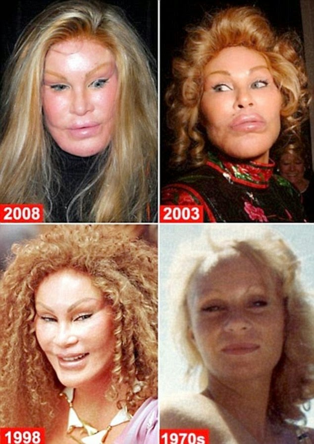 Life in Kuwait Blog Cosmetic Surgery Wow!