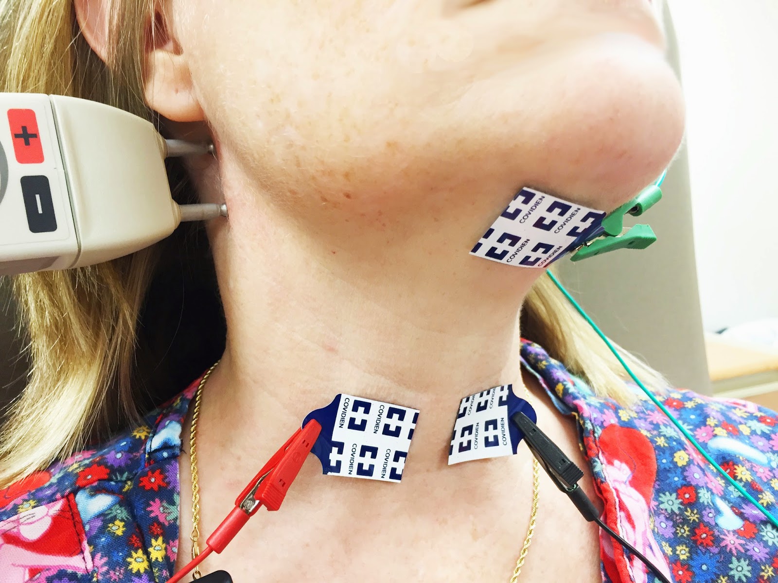 Diagnostic Test for Laryngeal Sensory Neuropathy (Chronic Cough