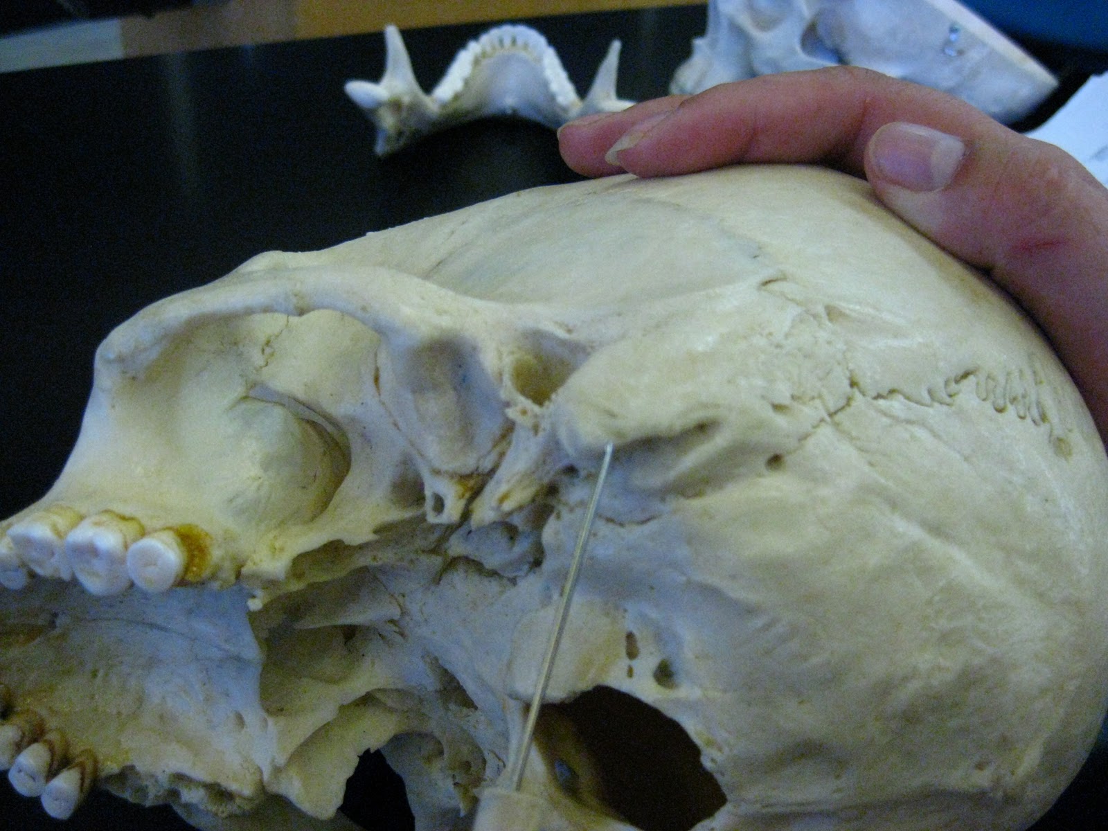 Boned: Human Skull - mastoid process (of temporal bone)
