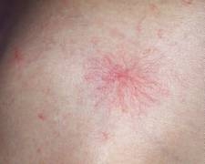 jinekoloji ve gebelik com