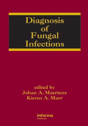 Diagnosis of Fungal Infections (Infectious Disease and Therapy) 