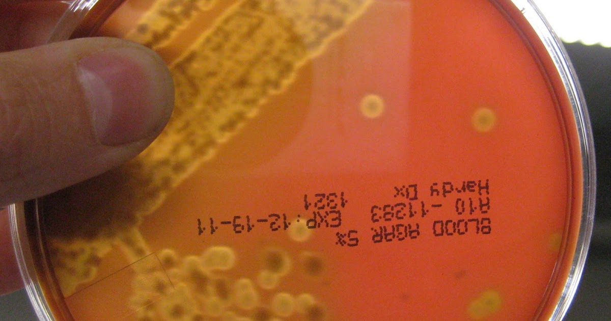 DVC Microbiology 146 Fall 11 (Gard) Lab 34 Throat Culture