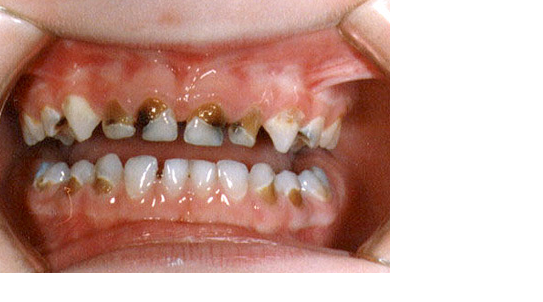 Common Dental Problem And Solution: Oral Health Problems ...