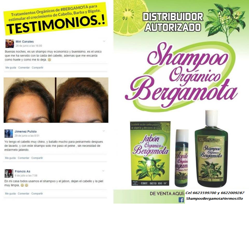 Lista 98+ Foto Shampoo De Bergamota Con Minoxidil Shelo Nabel El último