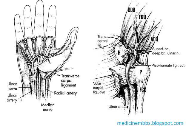 MBBS Medicine (Humanity First): Ulnar tunnel syndrome