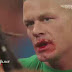 Brock Lenar le rompe la boca a John Cena en RAW