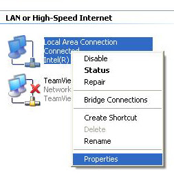 Local Area Connection Setting