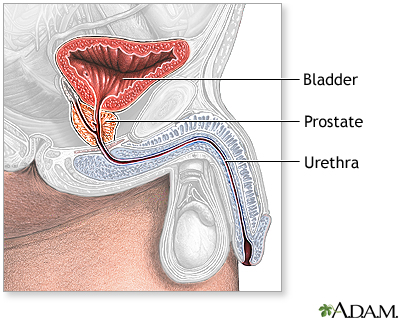 Robotic Prostatectomy Cost Uk