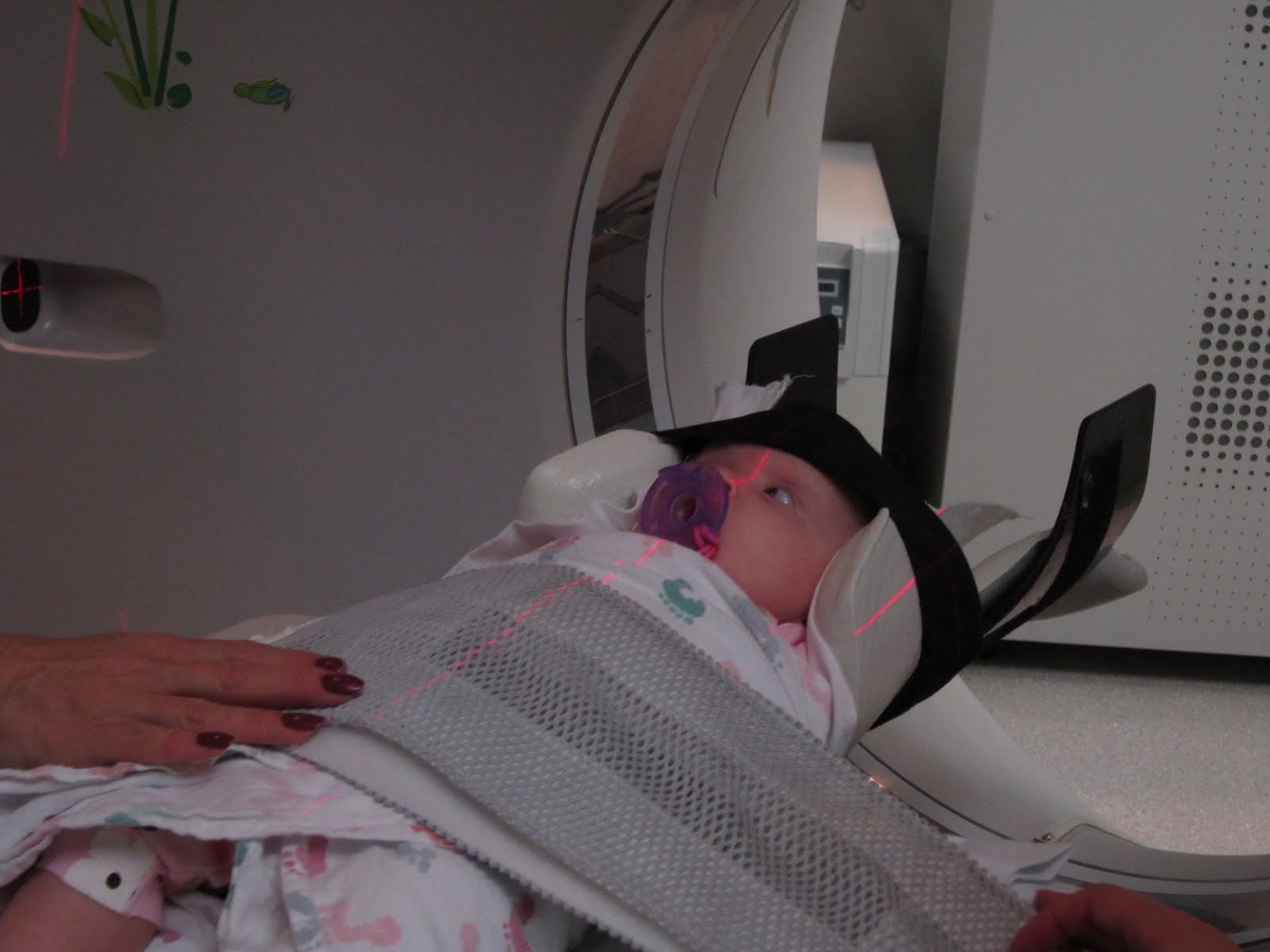 Ct+scan+brain+normal