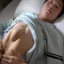 بالصور .. صيني يعيش 24 عاماً بقلب "جاحظ" من بطنه 