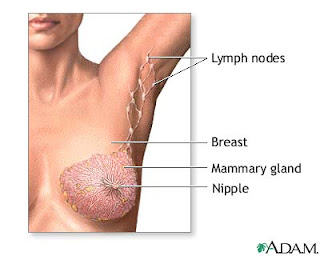 treatment options for breast cancer